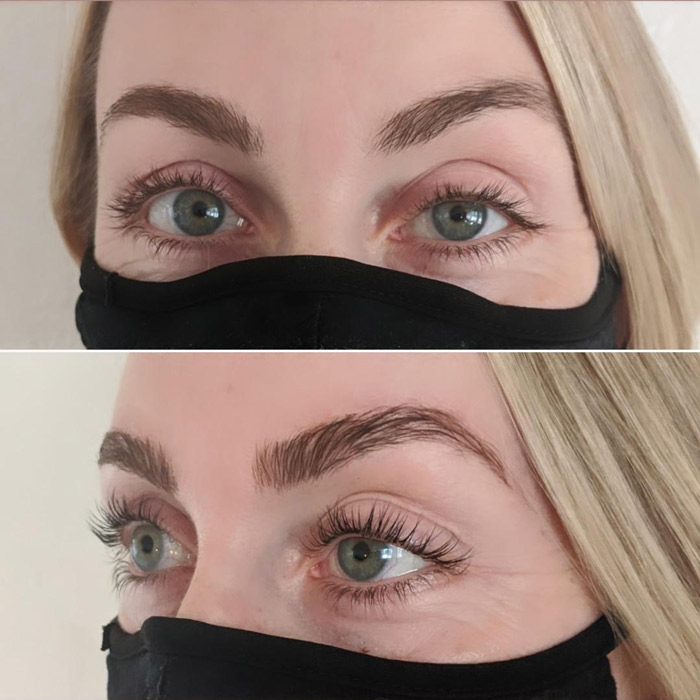 eyelash lift